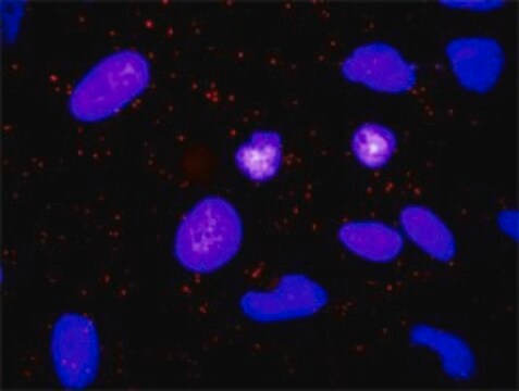 Anti-TGFA antibody produced in rabbit purified immunoglobulin, buffered aqueous solution