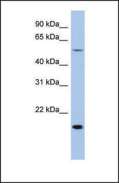 抗TEAD2抗体 ウサギ宿主抗体 affinity isolated antibody