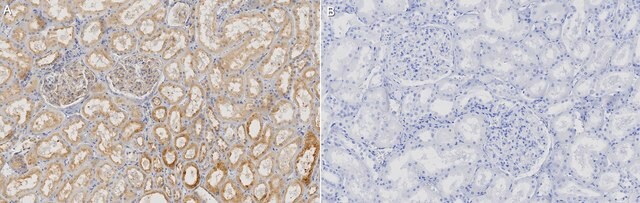 Anti-DNAJB9 Antibody, clone 1D16-K ZooMAb&#174; Rabbit Monoclonal recombinant, expressed in HEK 293 cells