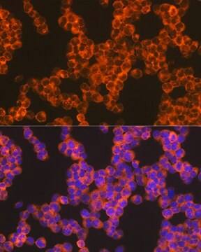 Anti-Oncostatin M Antibody, clone 8O8K9, Rabbit Monoclonal