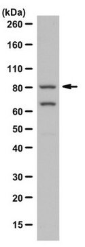 Anticorpo antiPI3-quinase, p85 from rabbit, purified by affinity chromatography