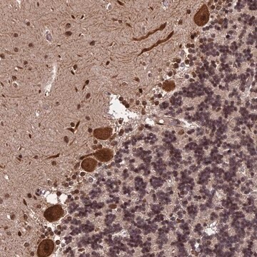 Anti-OSBPL1A antibody produced in rabbit Prestige Antibodies&#174; Powered by Atlas Antibodies, affinity isolated antibody, buffered aqueous glycerol solution