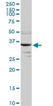 Anti-MMACHC antibody produced in rabbit purified immunoglobulin, buffered aqueous solution