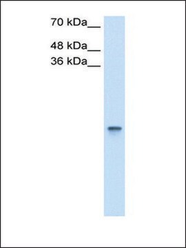 抗RBP1抗体 ウサギ宿主抗体 IgG fraction of antiserum