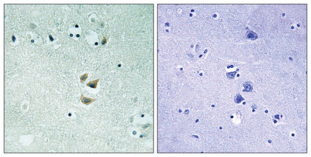 Anti-PRKCA antibody produced in rabbit affinity isolated antibody