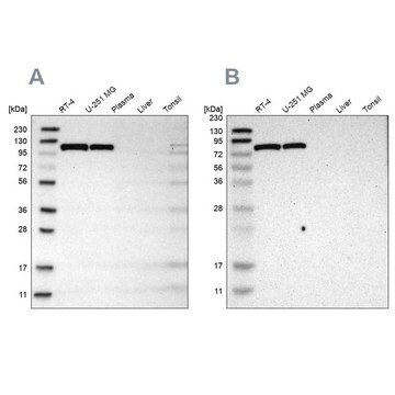 抗HK1抗体 ウサギ宿主抗体 Prestige Antibodies&#174; Powered by Atlas Antibodies, affinity isolated antibody, buffered aqueous glycerol solution