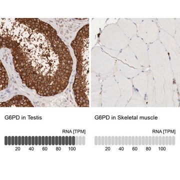 抗G6PD抗体 ウサギ宿主抗体 Prestige Antibodies&#174; Powered by Atlas Antibodies, affinity isolated antibody, buffered aqueous glycerol solution