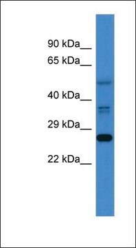 Anti-COMMD2 antibody produced in rabbit affinity isolated antibody