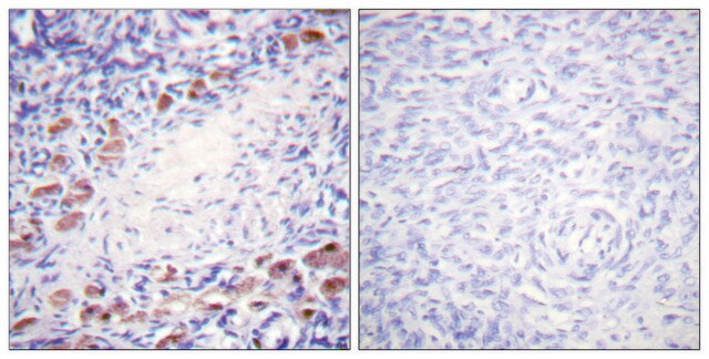 Anti-DAXX antibody produced in rabbit affinity isolated antibody