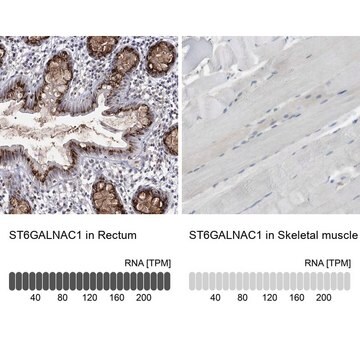 Anti-ST6GALNAC1 antibody produced in rabbit Prestige Antibodies&#174; Powered by Atlas Antibodies, affinity isolated antibody, buffered aqueous glycerol solution