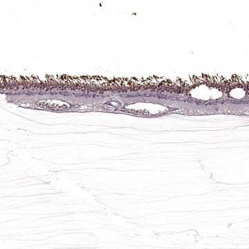 Anti-SAG antibody produced in rabbit Prestige Antibodies&#174; Powered by Atlas Antibodies, affinity isolated antibody