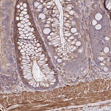 Anti-ZNF696 antibody produced in rabbit Prestige Antibodies&#174; Powered by Atlas Antibodies, affinity isolated antibody, buffered aqueous glycerol solution