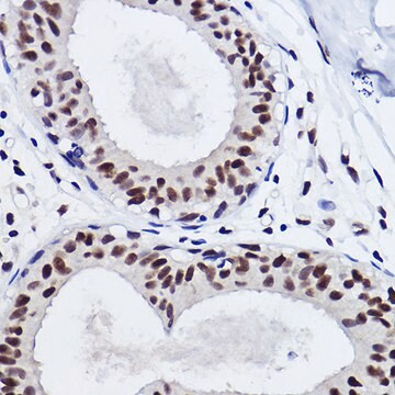 Anti-SNRPA1 Antibody, clone 2D7M1, Rabbit Monoclonal