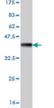 Monoclonal Anti-ALDH18A1 antibody produced in mouse clone 2B5, purified immunoglobulin, buffered aqueous solution