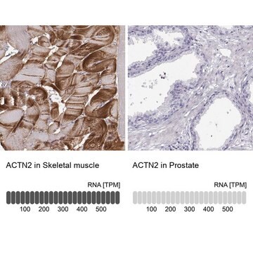 Anti-ACTN2 antibody produced in rabbit Prestige Antibodies&#174; Powered by Atlas Antibodies, affinity isolated antibody, buffered aqueous glycerol solution