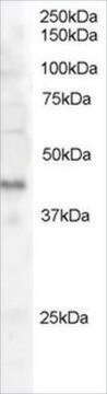 Anti-Dysadherin antibody produced in goat affinity isolated antibody, buffered aqueous solution