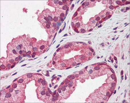 Anti-PTX3 antibody produced in rabbit affinity isolated antibody