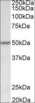 Anti-PDCD4 antibody produced in goat affinity isolated antibody, buffered aqueous solution