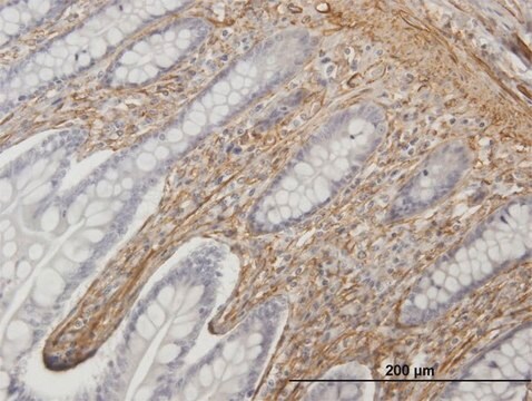 Anti-CALD1 antibody produced in mouse purified immunoglobulin, buffered aqueous solution