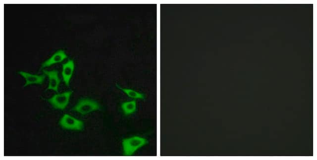 Anti-FZD8 antibody produced in rabbit affinity isolated antibody