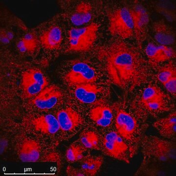 Colorant pour vimentine BioTracker&nbsp;TiY&nbsp;Vimentin pour cellules vivantes Live cell imaging probe for identifying tumor initiating cells (TICs) in a variety of epithelial cancers, including lung cancer. The TiY probe binds to vimentin expressed in TICs.