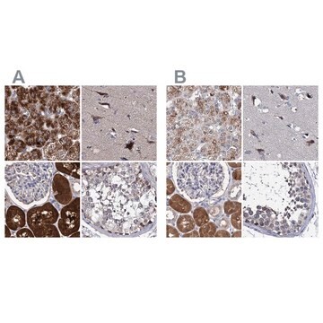 Anti-CLPB antibody produced in rabbit Prestige Antibodies&#174; Powered by Atlas Antibodies, affinity isolated antibody, buffered aqueous glycerol solution