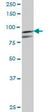 Anti-PFKM antibody produced in mouse purified immunoglobulin, buffered aqueous solution