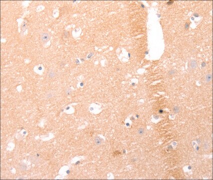 Anti-AMH antibody produced in rabbit affinity isolated antibody