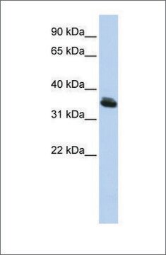 抗LHX3抗体 ウサギ宿主抗体 affinity isolated antibody