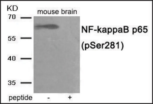 Anti-phospho-NF-&#954;B p65 (pSer281) antibody produced in rabbit affinity isolated antibody