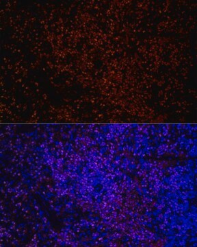 Anti-IKZF3 Antibody, clone 4U7F9, Rabbit Monoclonal