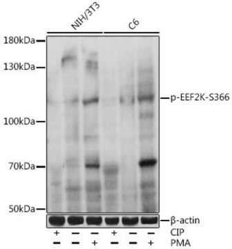 Anti-Phospho-EEF2K-S366 antibody produced in rabbit