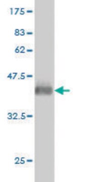 ANTI-GUCY2D antibody produced in mouse clone 6E9, purified immunoglobulin, buffered aqueous solution