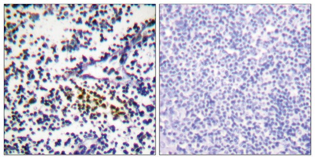 Anti-NYREN18 antibody produced in rabbit affinity isolated antibody