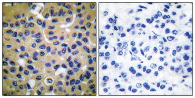 抗 胶原 II 兔抗 affinity isolated antibody