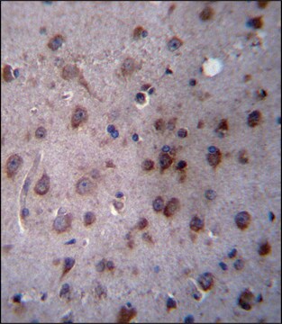 ANTI-TMED2 (N-TERM) antibody produced in rabbit IgG fraction of antiserum, buffered aqueous solution