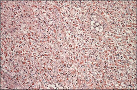 抗線維芽細胞増殖因子-塩基性 (1-24) ウサギ宿主抗体 fractionated antiserum, lyophilized powder