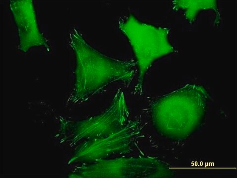 Anti-ZYX antibody produced in mouse purified immunoglobulin, buffered aqueous solution