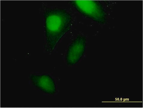 Monoclonal Anti-CRABP2 antibody produced in mouse clone 4F2, purified immunoglobulin, buffered aqueous solution