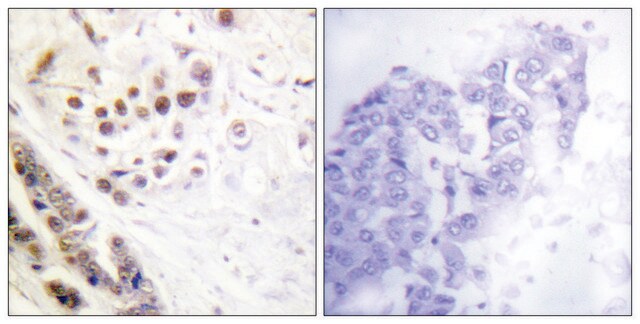 Anti-Histone H2A antibody produced in rabbit affinity isolated antibody