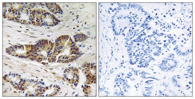 Anti-GRK2 antibody produced in rabbit affinity isolated antibody