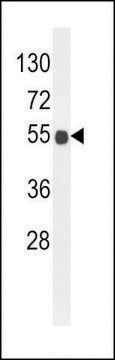 ANTI-B3GNT6 (CENTER) antibody produced in rabbit affinity isolated antibody, buffered aqueous solution