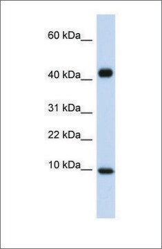 抗CCL8抗体 ウサギ宿主抗体 affinity isolated antibody