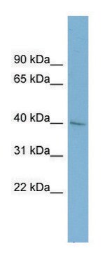 Anti-A4GALT antibody produced in rabbit affinity isolated antibody