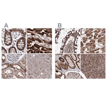 抗PDHX抗体 ウサギ宿主抗体 Prestige Antibodies&#174; Powered by Atlas Antibodies, affinity isolated antibody, buffered aqueous glycerol solution