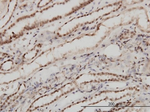 Monoclonal Anti-TSG101 antibody produced in mouse clone 5B7, purified immunoglobulin, buffered aqueous solution