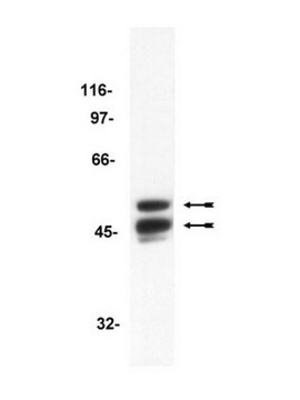 Przeciwciało anty-GSK3, klon 4G-1E clone 4G-1E, Upstate&#174;, from mouse