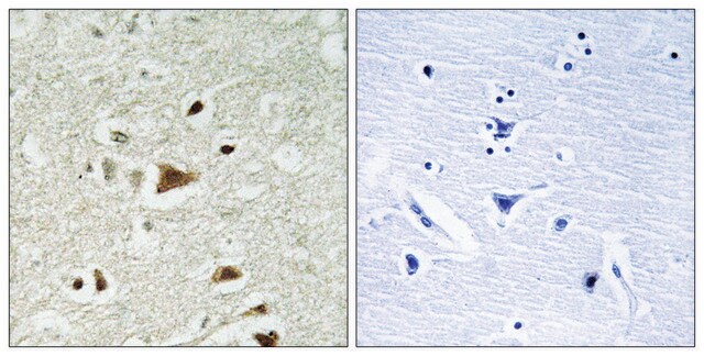 Anti-SMAD2 antibody produced in rabbit affinity isolated antibody