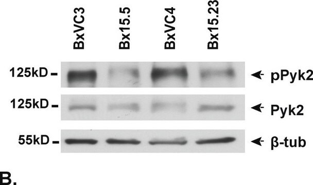 Anti-Pyk2 Antibody Upstate&#174;, from rabbit