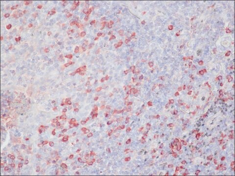 抗ニワトリIgY (IgG) (全分子)&#8722;ペルオキシダーゼ ウサギ宿主抗体 affinity isolated antibody, buffered aqueous solution